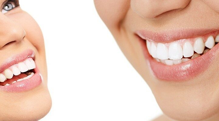 Cosmetic Dentist | Blog | Ash Dental Irvine