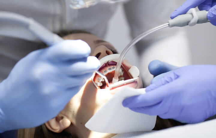 Cosmetic Dentist Procedures